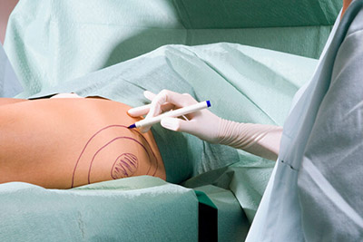 Istanbul-liposuction,removes excess fat deposits istanbul-liposuction,Liposuction is performed with small inconspicuous incisions.