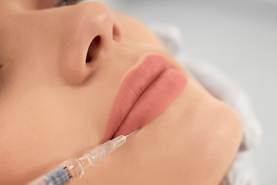 Bullhorn lip lift,Direct lip lift Istanbul-Lip Lifting,Upper lip procedure
