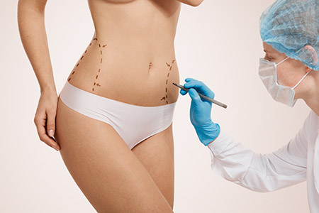 Istanbul-Tummy Tuck Surgery (Abdominoplasty) Istanbul-Tummy Tuck Surgery (Abdominoplasty)
