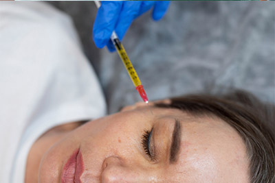 Istanbul-Platelet-rich plasma Istanbul-Platelet-rich plasma (PRP)