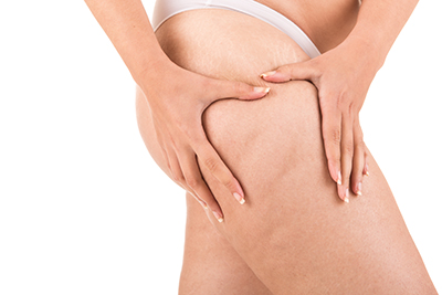 Turkey,Istanbul-Thigh Lift Surgery Istanbul-Thigh Lift Surgery