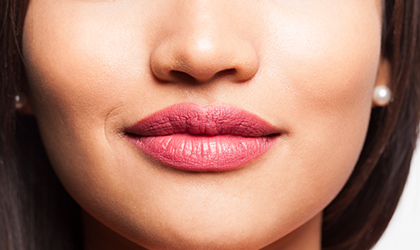 Non-surgical lip lifting,Recovering in the upper lip procedure Turkey-Lip lifting,Italian lip lift
